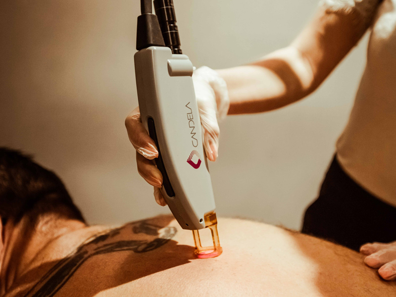 Laser Hair Removal For Men Face Of Man