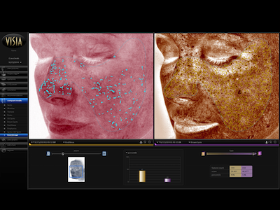 Tech Alert: The Future of Skin Analysis is Here Tech Alert: The Future of Skin Analysis is Here